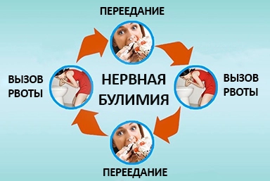 Лечение булимии в Троицке
